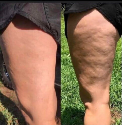 NooraWell™ - Anti-cellulite Massage Oil