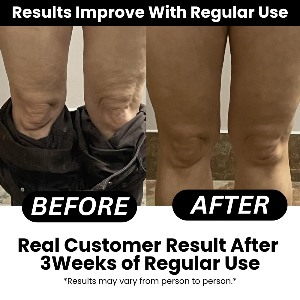 NooraWell™ - Anti-cellulite Massage Oil