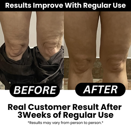 NooraWell™ Anti-Cellulite Massage Roller